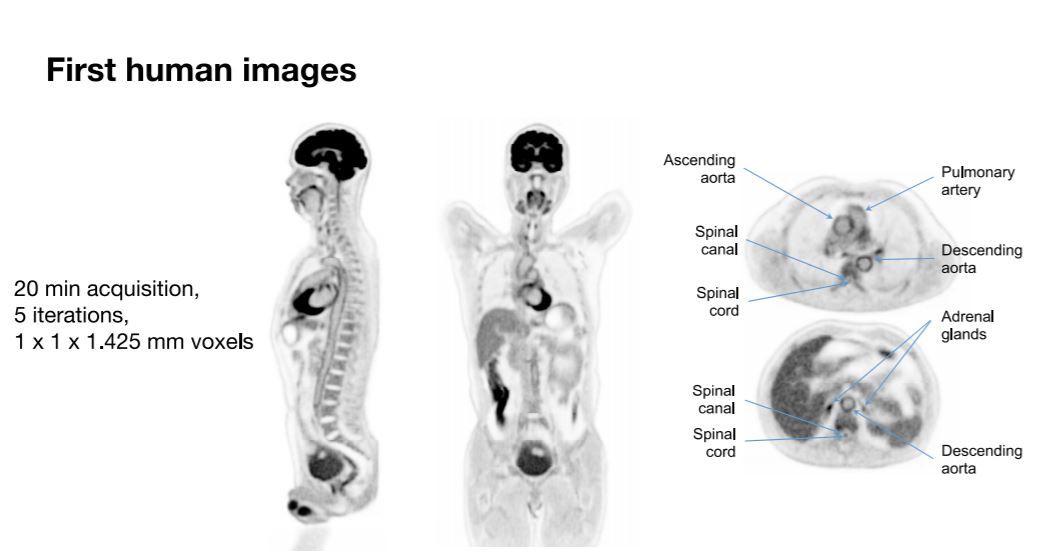 First human 3D scans by EXPLORER.