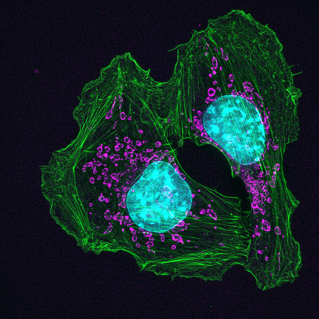 Mouse skin cancer cells.