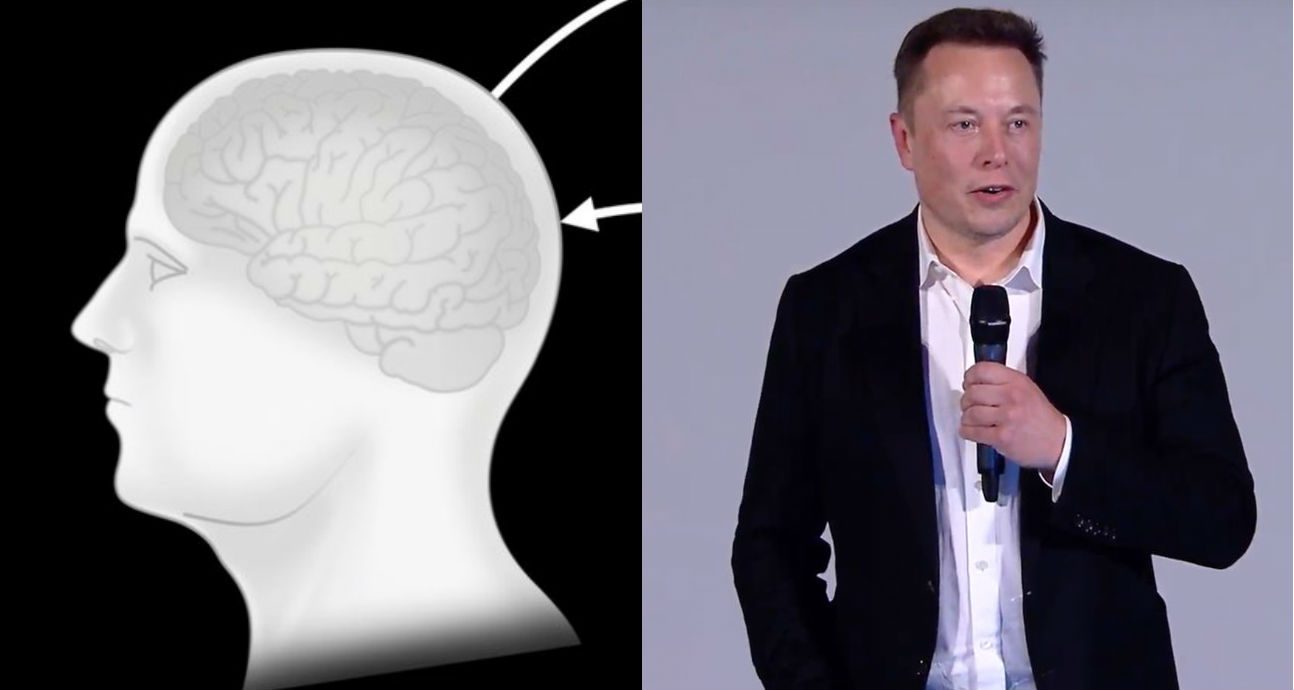 elon musk neuralink ile ilgili gÃ¶rsel sonucu