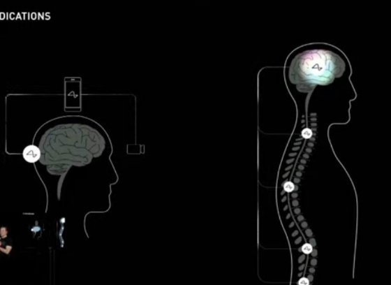 Elon Musk is confident Neuralink will restore vision & full body functionality
