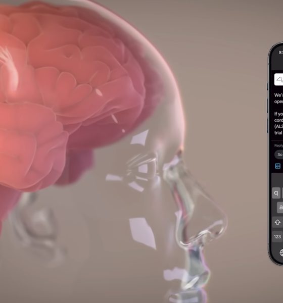 Elon-musk-neuralink-first-patient-trial-recovery